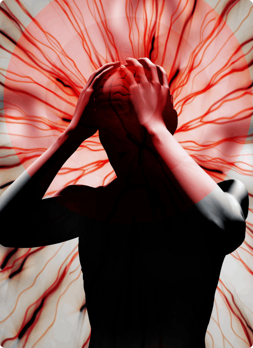Understanding Migraine Basics